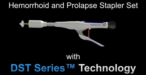 Phẫu thuật Longo